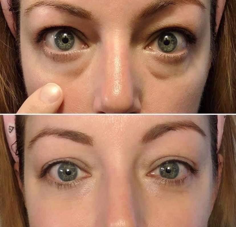 Crème magique | Visage sans rides ni poches en 3 min