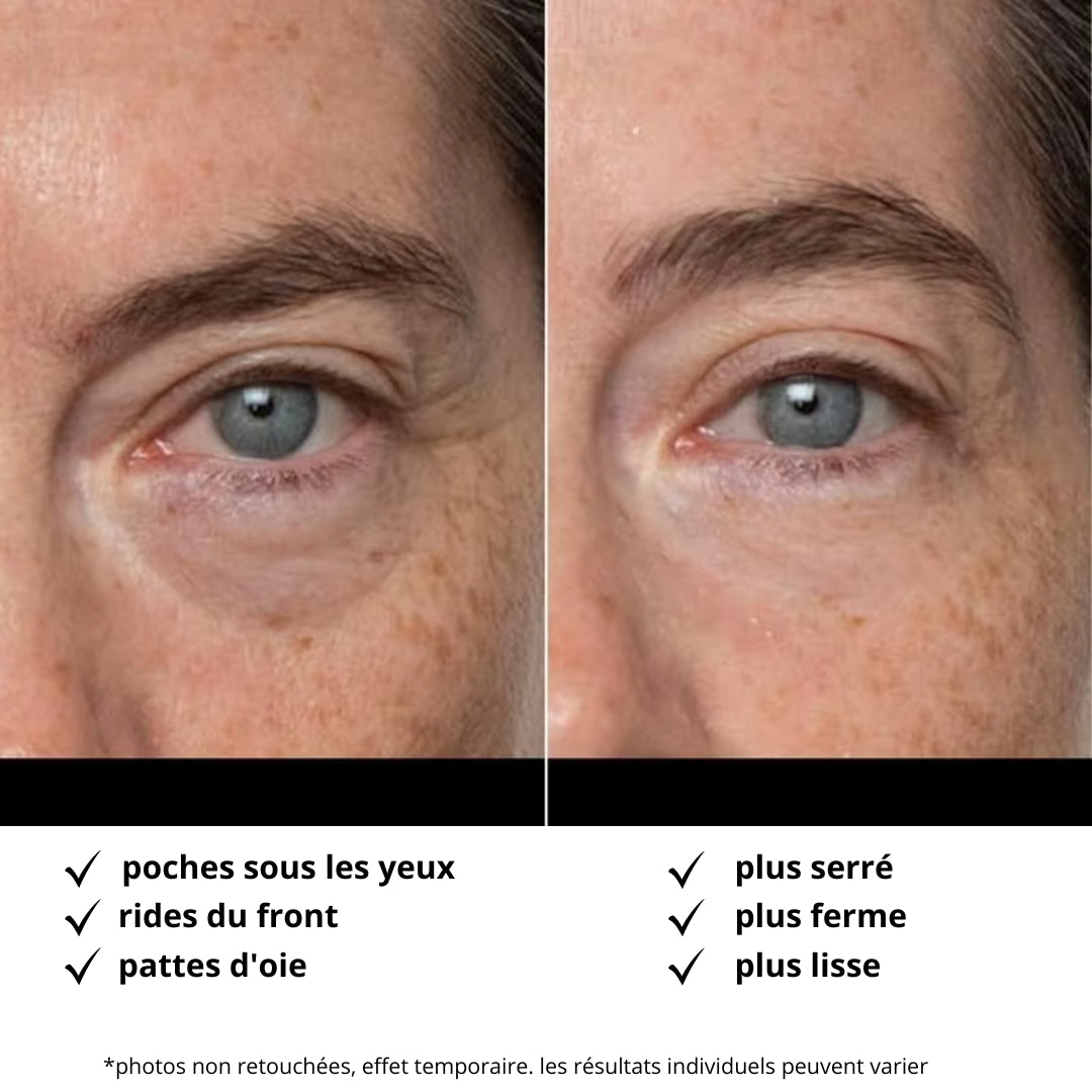 Crème magique | Visage sans rides ni poches en 3 min
