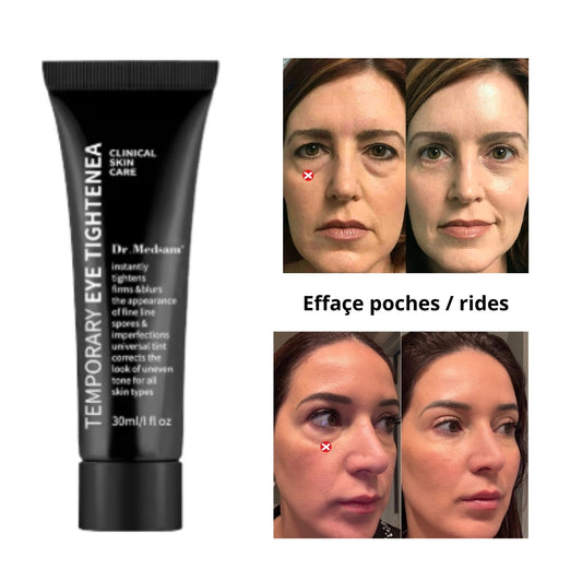 Crème magique | Visage sans rides ni poches en 3 min